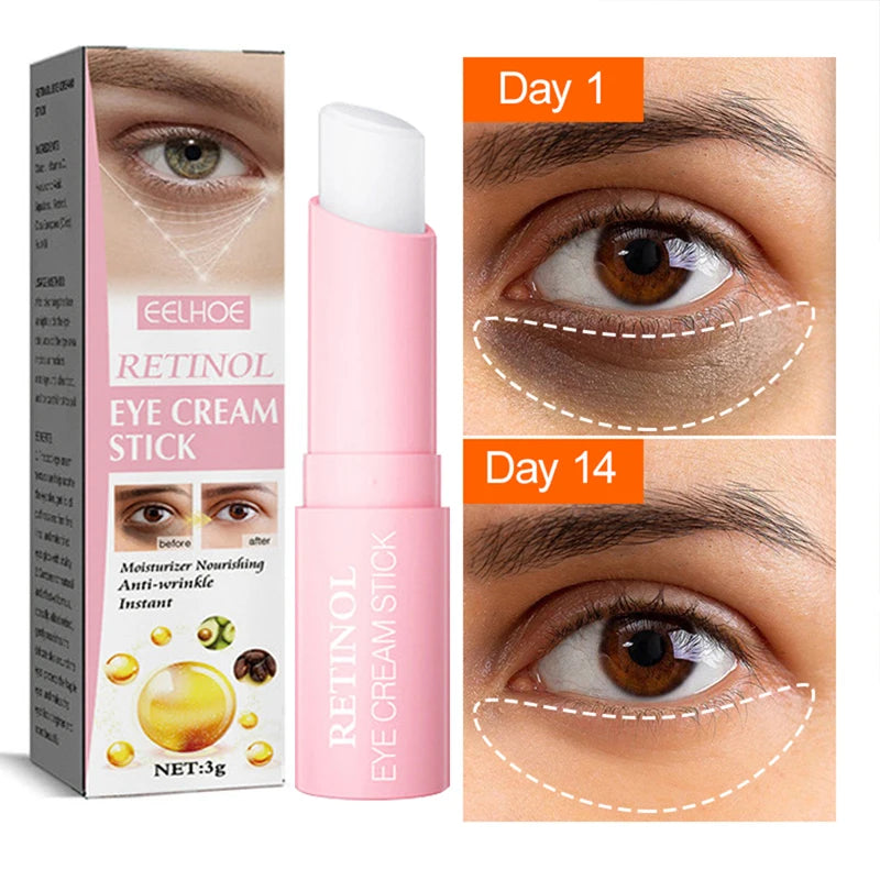 Eye Cream Instant Removing Eyes Wrinkle